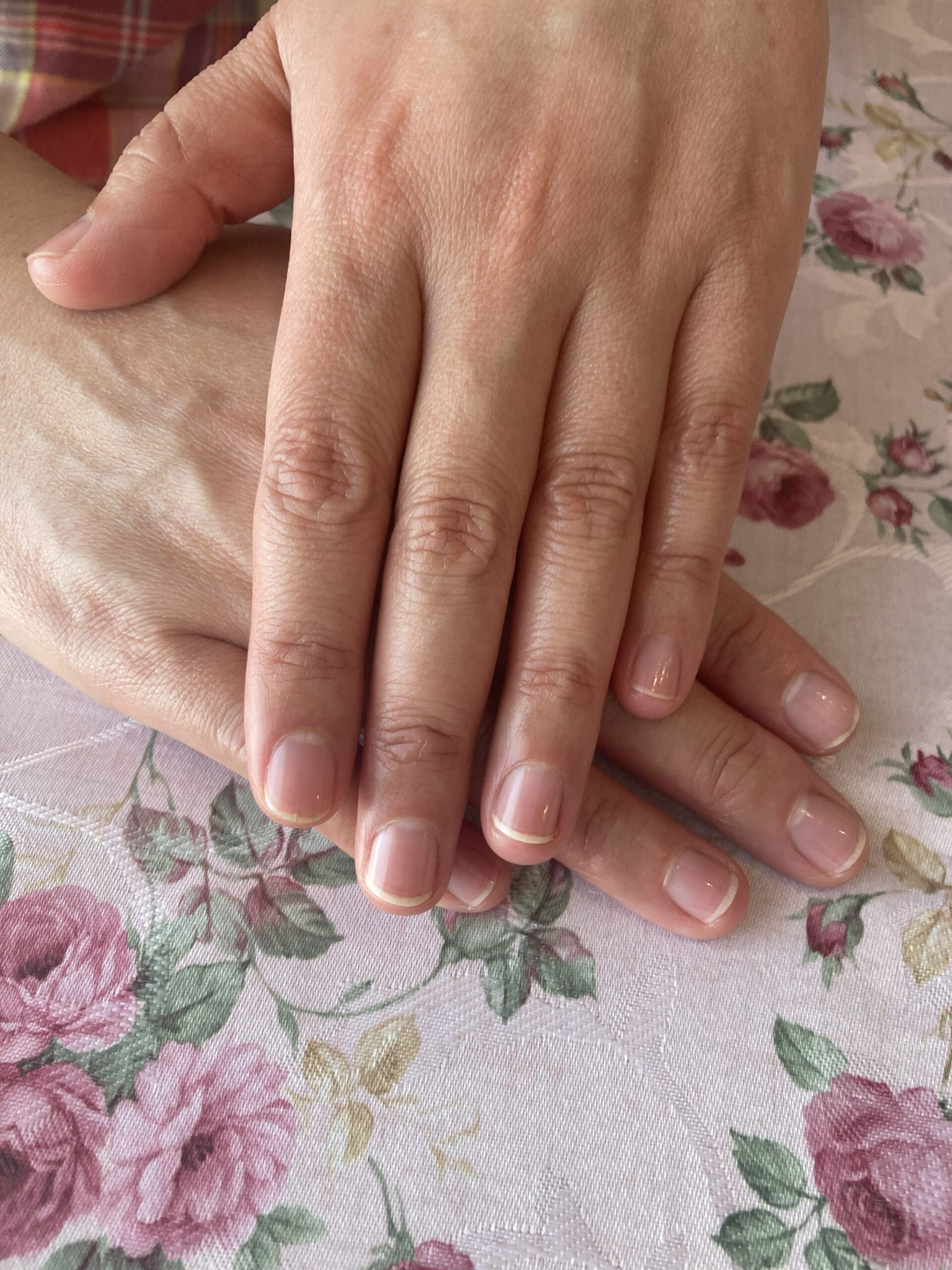 【お客様の声】60代女性「爪をみるたびにニンマリ」福岡市の自宅訪問ネイルケア